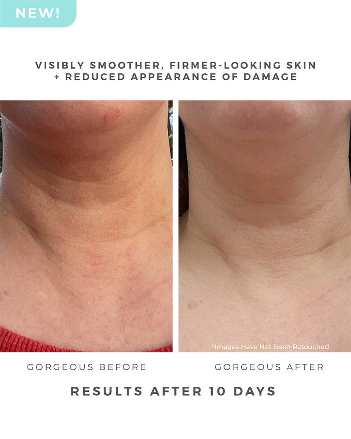 Before/after image of woman's neck area. Includes text: Visibly smoother, firmer-looking skin + reduced appearance of damage. Results after 10 days.