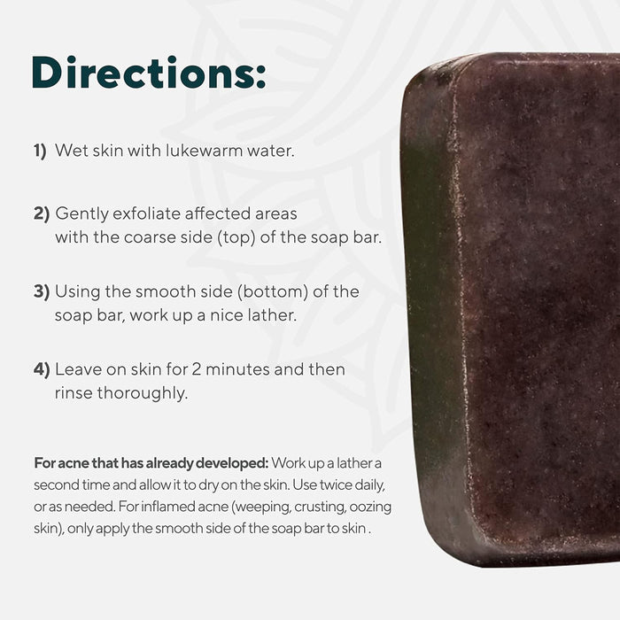 To the right of step-by-step usage directions—including exfoliating and care for inflamed acne—is a rectangular bar of Marie Originals Acne Control Soap. The scene features a light background with a subtle abstract pattern.