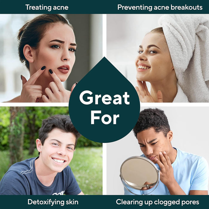 A collage of four people using Marie Originals Acne Control Soap for treating acne, preventing breakouts, detoxifying skin with clay, and clearing pores with natural salicylic acid, centered around "Great For" on a dark droplet shape.