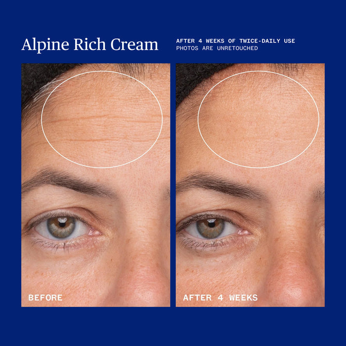 Close-up comparing a person’s forehead and eyes before and after 4 weeks using Ursa Major Alpine Rich Cream, revealing fewer lines and smoother skin due to its effective moisturizing and skin barrier support.