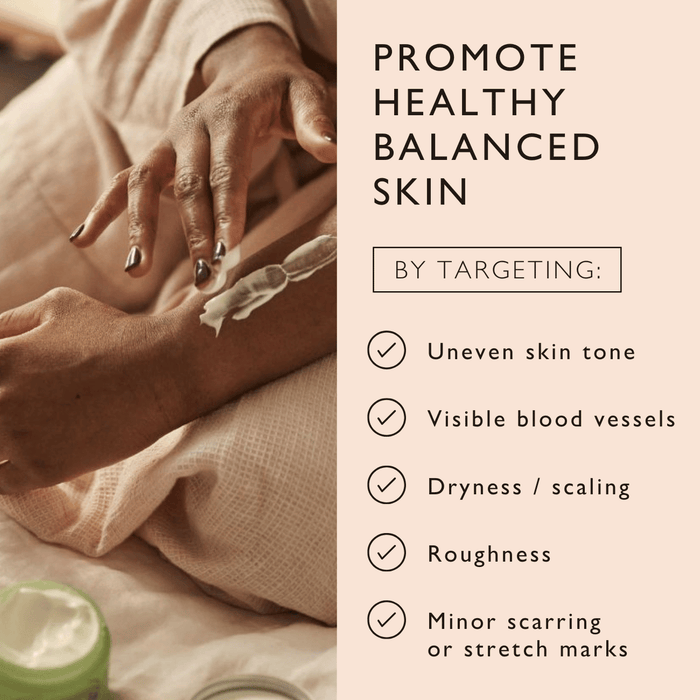 Person applying cream to their hand, sitting on a bed. A text overlay lists skincare benefits: "Uneven skin tone, Visible blood vessels, Dryness/scaling, Roughness, Minor scarring or stretch marks." Cream jar in the foreground.