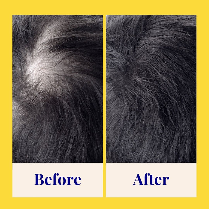 Compare the hair before and after using The Powder Shampoos Invigorating & Stimulating Powder Shampoo. The left side shows thinning hair with a visible scalp, labeled Before, while the right side showcases thicker, fuller hair, labeled After. The background is yellow.