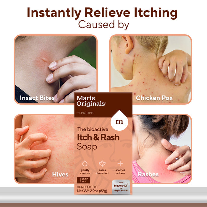 A promotional image for Marie Originals Itch Relief Soap highlights close-ups of irritated skin from insect bites, chicken pox, hives, and rashes, demonstrating this natural solution’s effectiveness for sensitive skin itch relief.