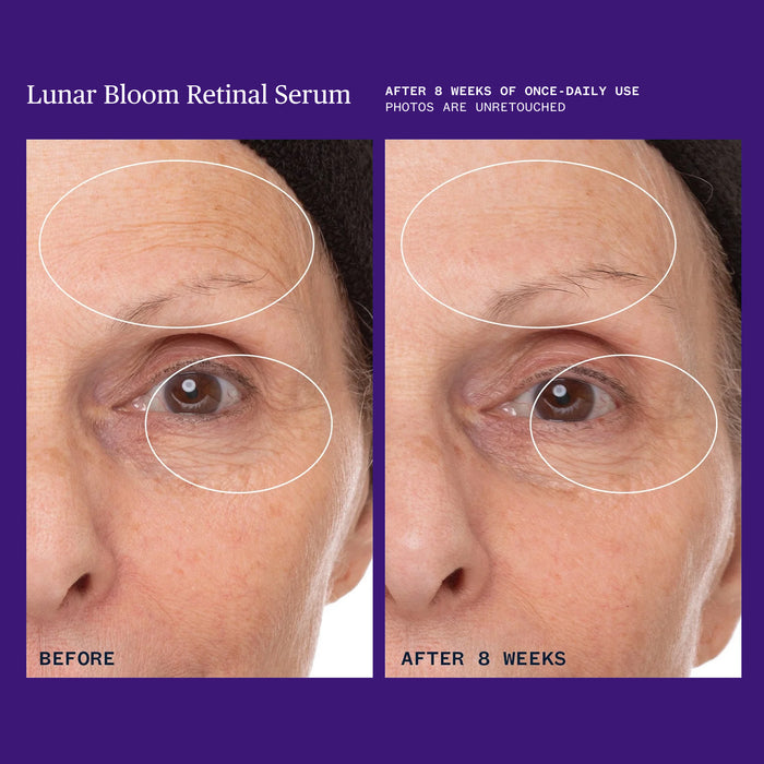 Close-up comparison of a woman’s eye area before and after 8 weeks using Ursa Major Lunar Bloom Retinal Serum, with white circles highlighting visible reduction in fine lines and smoother skin texture.
