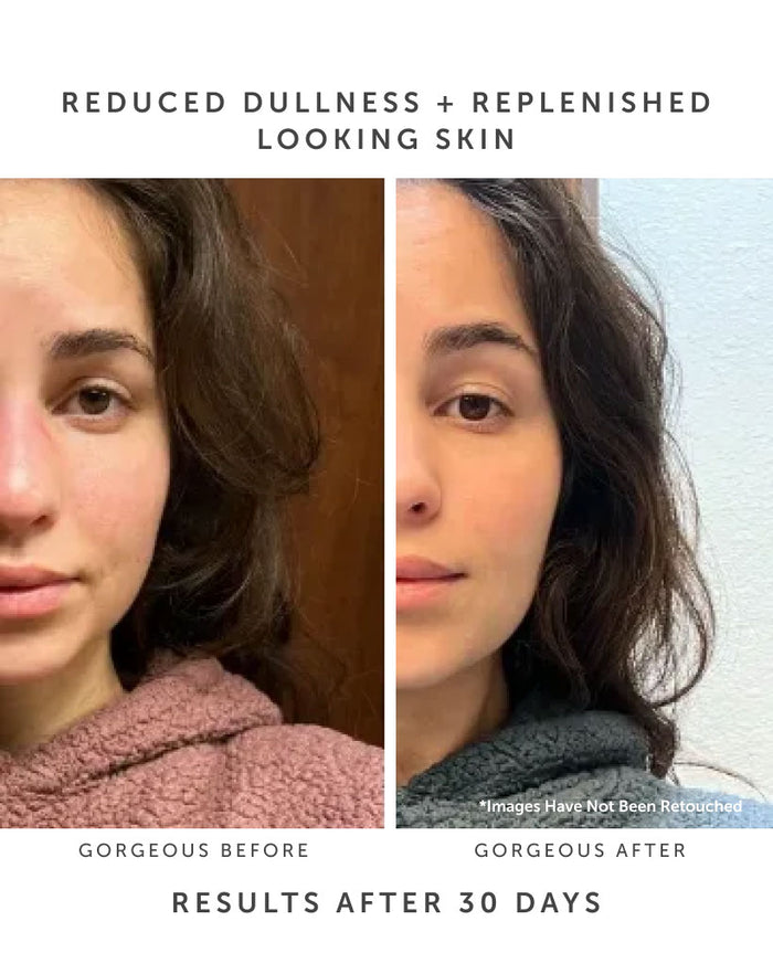 Split image reveals a womans transformation before and after 30 days with Earth Harbors MARINA Biome Brightening Ampoule. Left shows slight redness and dullness; right displays smoother, even-toned skin, thanks to ocean-blue botanicals.