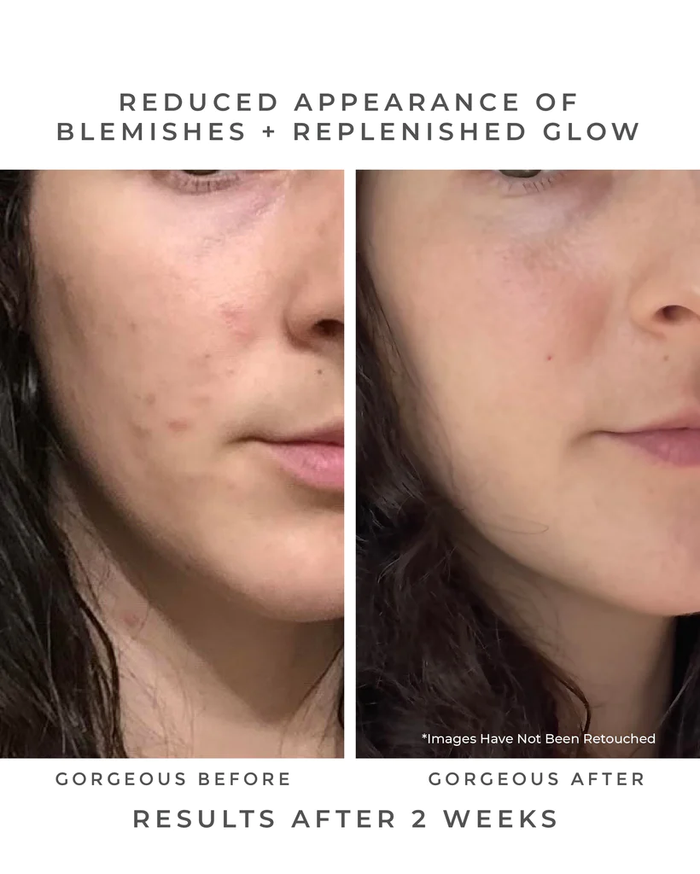 Before/after photo shows an upclose shot of face. Includes the text: Reduced appearance of blemishes + replenished glow. Results after 2 weeks.