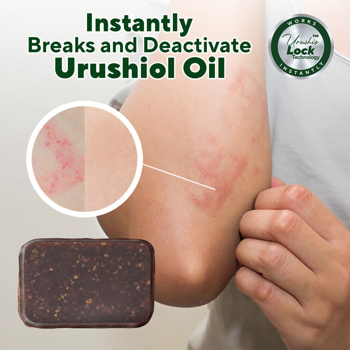 A person scratches a rash on their inner elbow. A magnified circle highlights the irritation as Marie Originals Poison Ivy & Oak Relief Soap appears below. Text reads: Instantly breaks and deactivates urushiol oil for fast poison ivy relief.