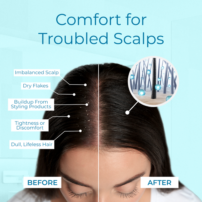 Split-screen image of a woman’s scalp labeled before and after. Left: dry flakes, buildup, and listed scalp concerns. Right: clean, healthy scalp with visible follicles—thanks to Tree To Tub Instant Relief Calming Scalp & Hair Spray.