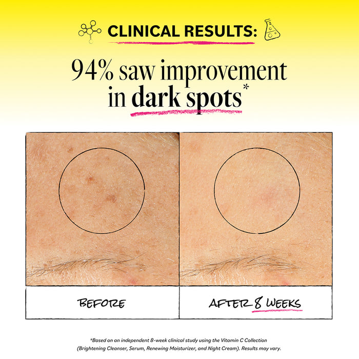 Side-by-side images of skin display dark spots before and after 8 weeks. Text: Clinical Results: 94% saw improvement in dark spots. The after image reveals lighter, less noticeable dark spots—thanks to the powerful benefits of Derma E Vitamin C Intense Night Cream.