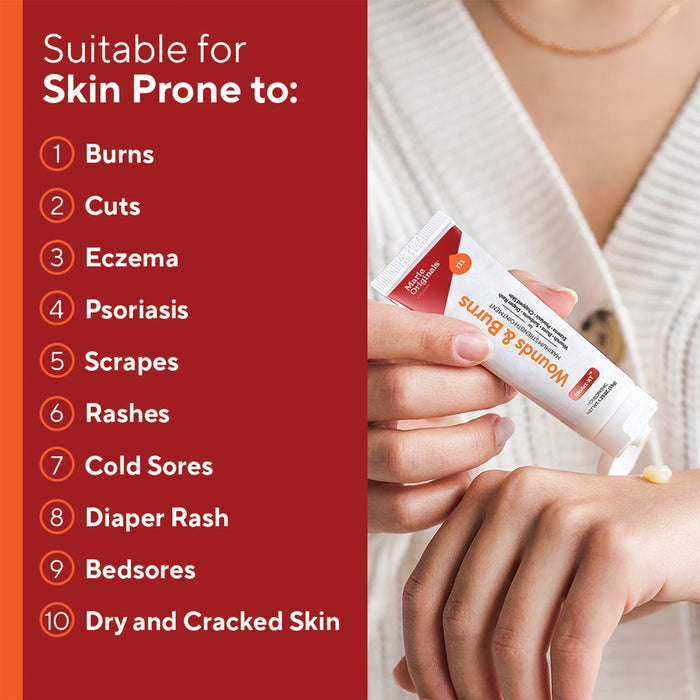 A person applies Marie Originals Wounds & Burns Cream to their hand next to a red list showing its use for burns, cuts, eczema, psoriasis, scrapes, rashes, cold sores, diaper rash, bedsores, and dry or cracked skin.